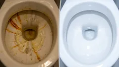 Vain kolme tippaa poistaa ruosteen ja kalkkikertymät wc-istuimesta helposti