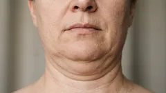 5 harjoitusta, jotka auttavat pääsemään eroon kaksoisleukasta